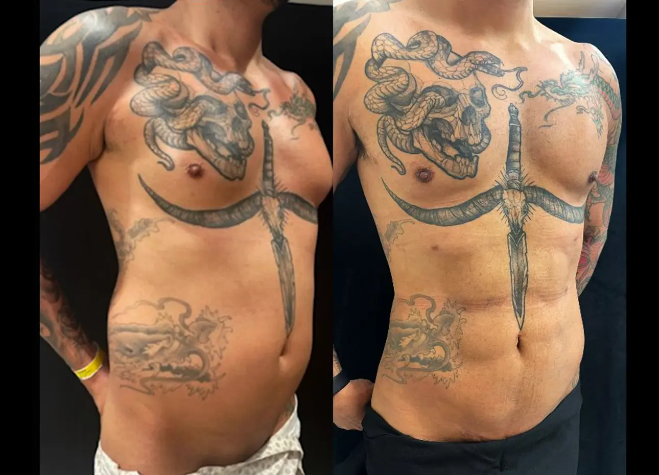 22
